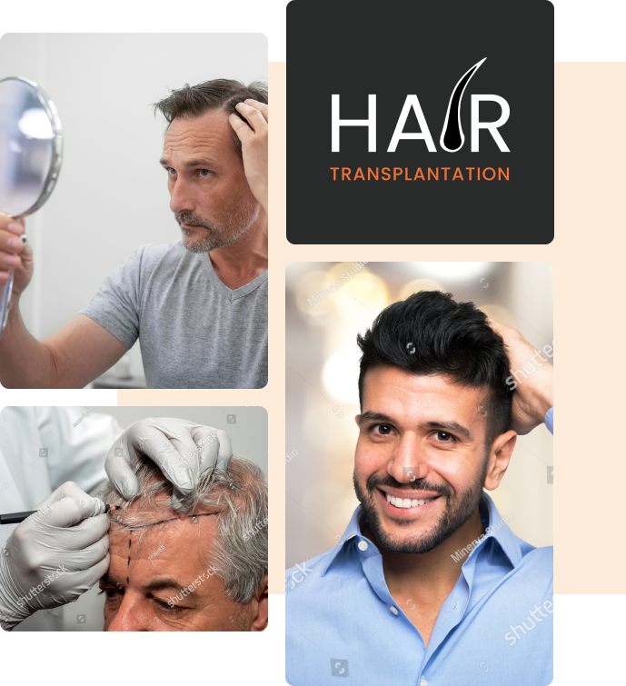 hair transplant