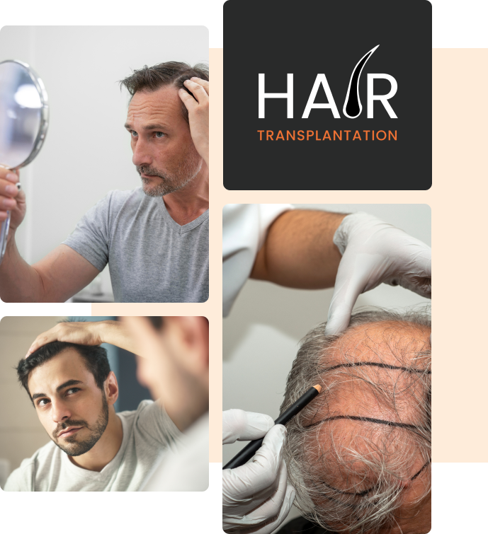 hair transplant