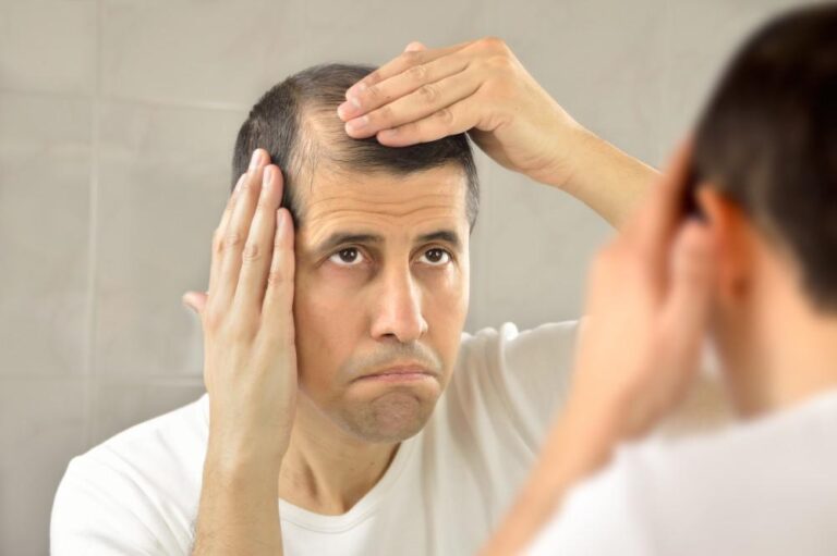 5 Signs You Need a Hair Transplant in Melbourne