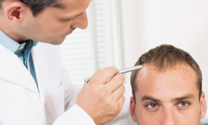 Receding Hairline: Causes, Early Signs and Treatment Options