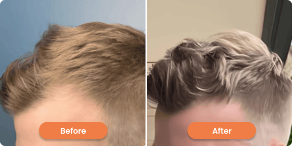 before after 01
